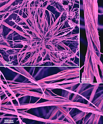 False color image of peptide nanofibers that have bundled and twisted together